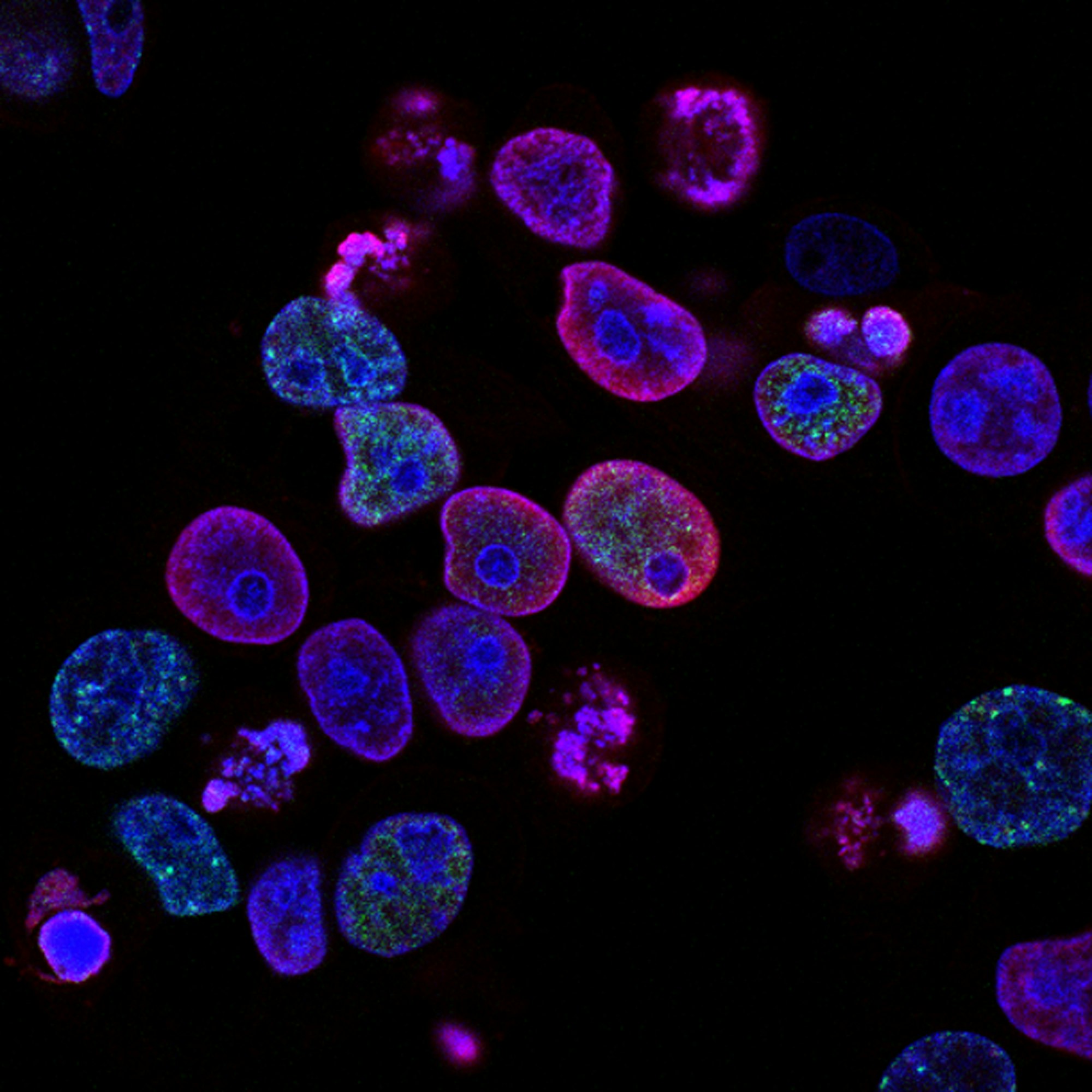 Fluorescence micrograph